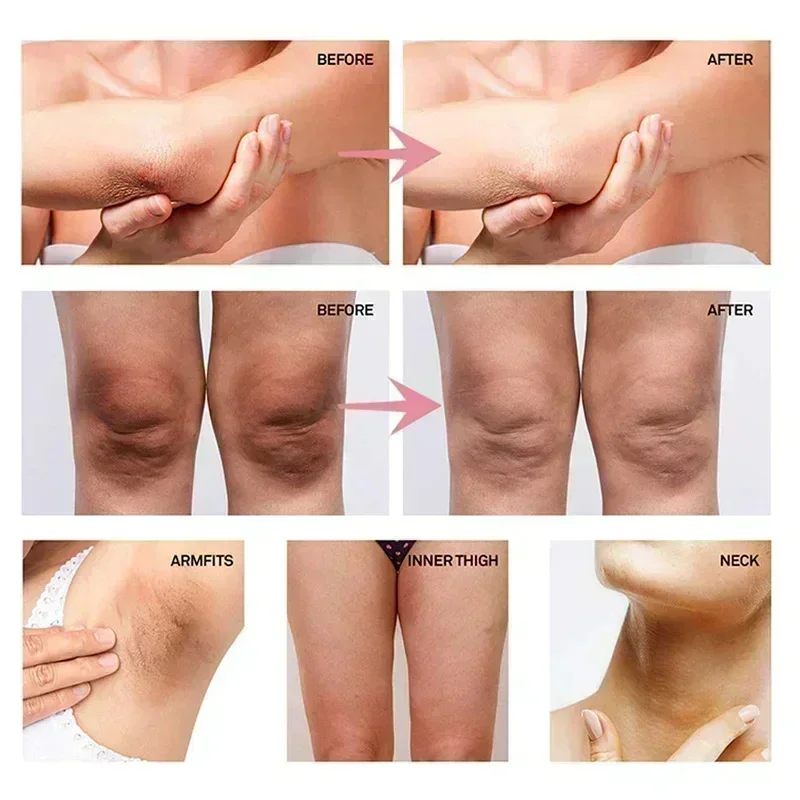 Collagen underarm whitening cr - Anti-Aging Face Cream reseña y precio