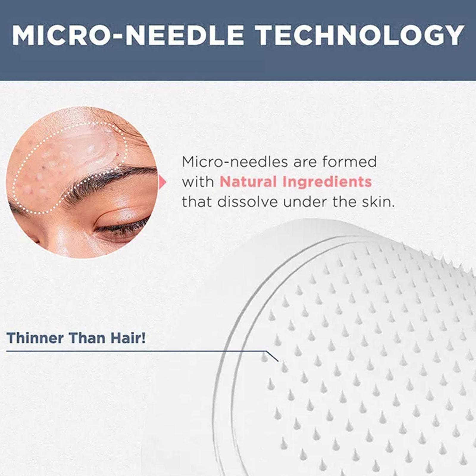 0.2mm Micro-needle Eye Patch M - Collagen Eye Patch reseña y precio