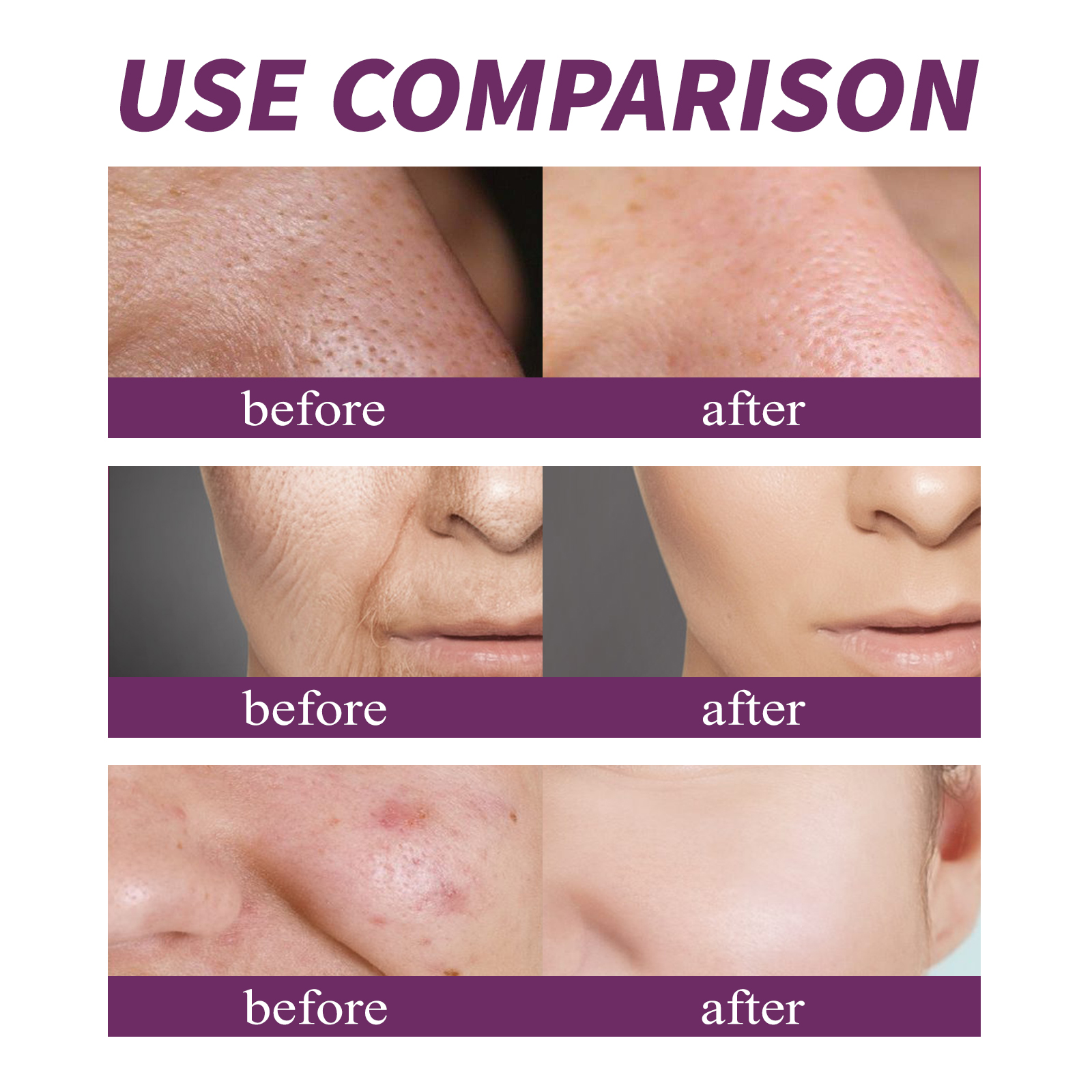 20% Niacinamide B3 Concentrate - Anti-Aging Face Cream reseña y precio
